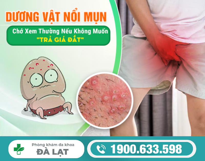 Hình ảnh minh họa